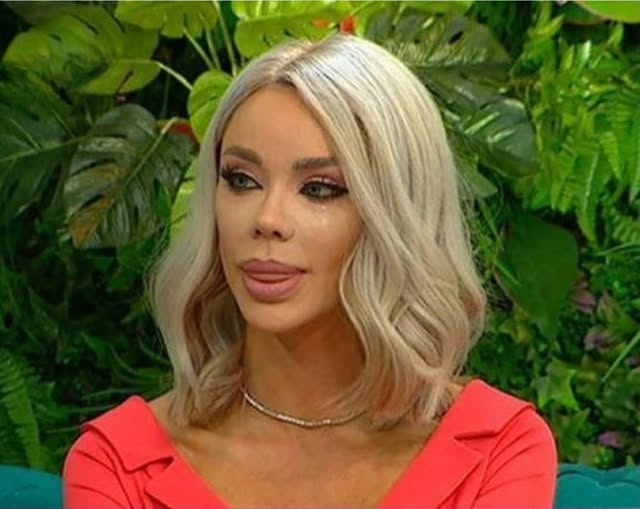 Bianca Drăgușanu tună și fulgeră! „Să nu faceți asta, niciodată, la nimeni. M-au MUTILAT!”