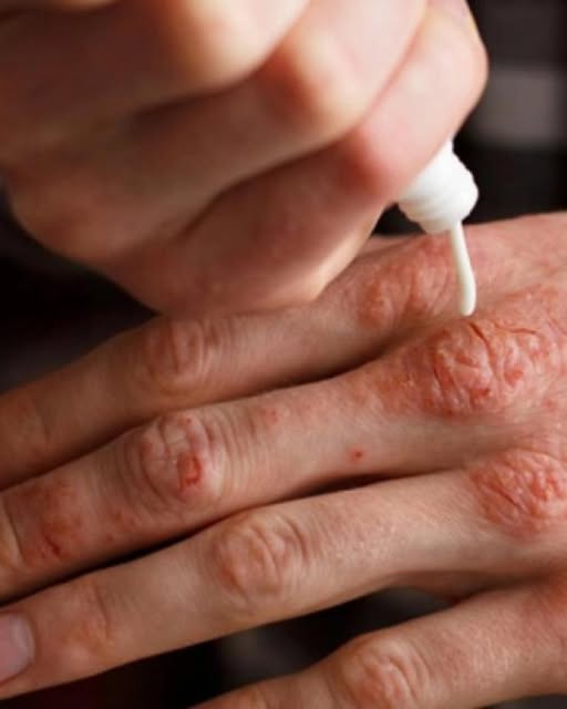 Acestea sunt primele SEMNE ale unei b… Vezi mai mult