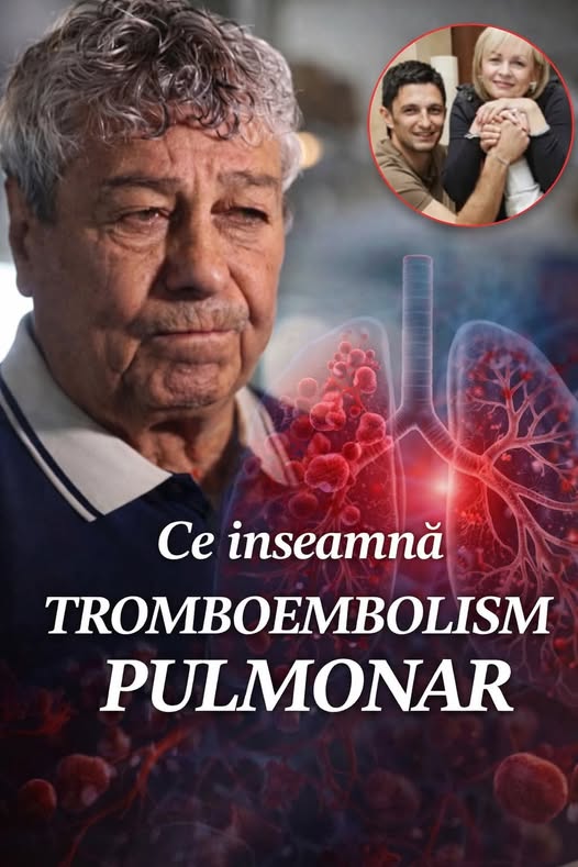 Ce sunt focarele de tromboembolism pulmonar. I-au fost descoperite lui Mircea Lucescu înainte să se stinga