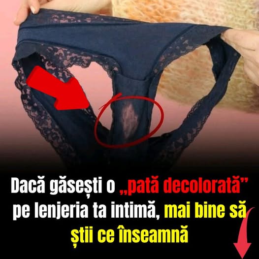 Ce înseamnă o „pată decolorată” pe lenjeria ta intimă – vezi mai multe