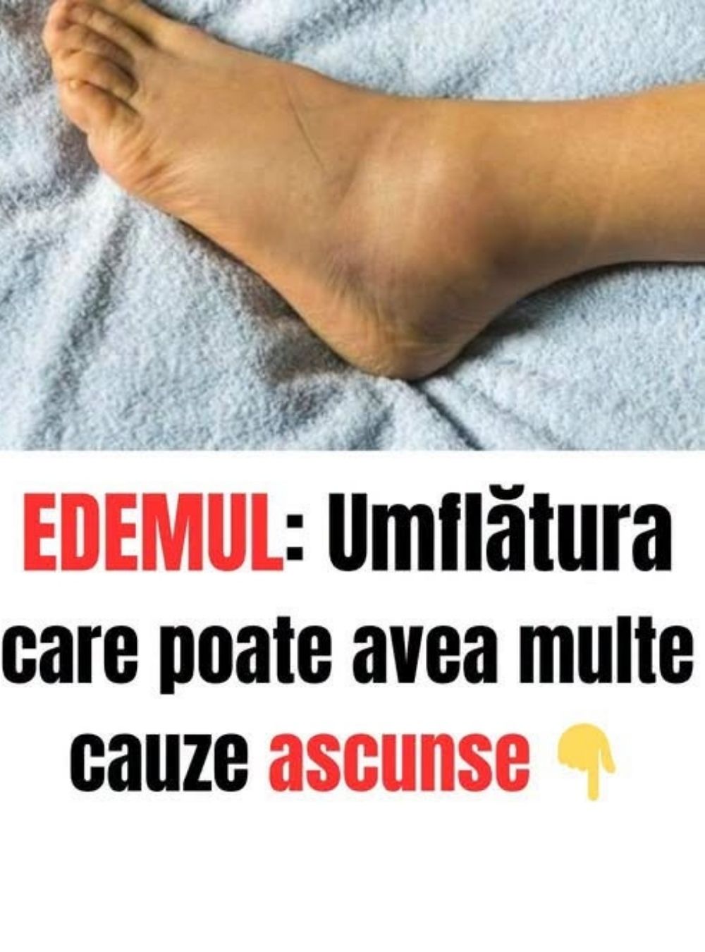 Acesta este un semn că ceva nu este în regulă. Ce trebuie să știi despre umflături