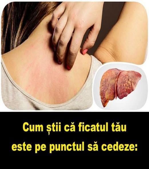 Ce spun picioarele despre sănătatea ta. Semnele care pot ascunde diabet, cheaguri sau boli de inimă
