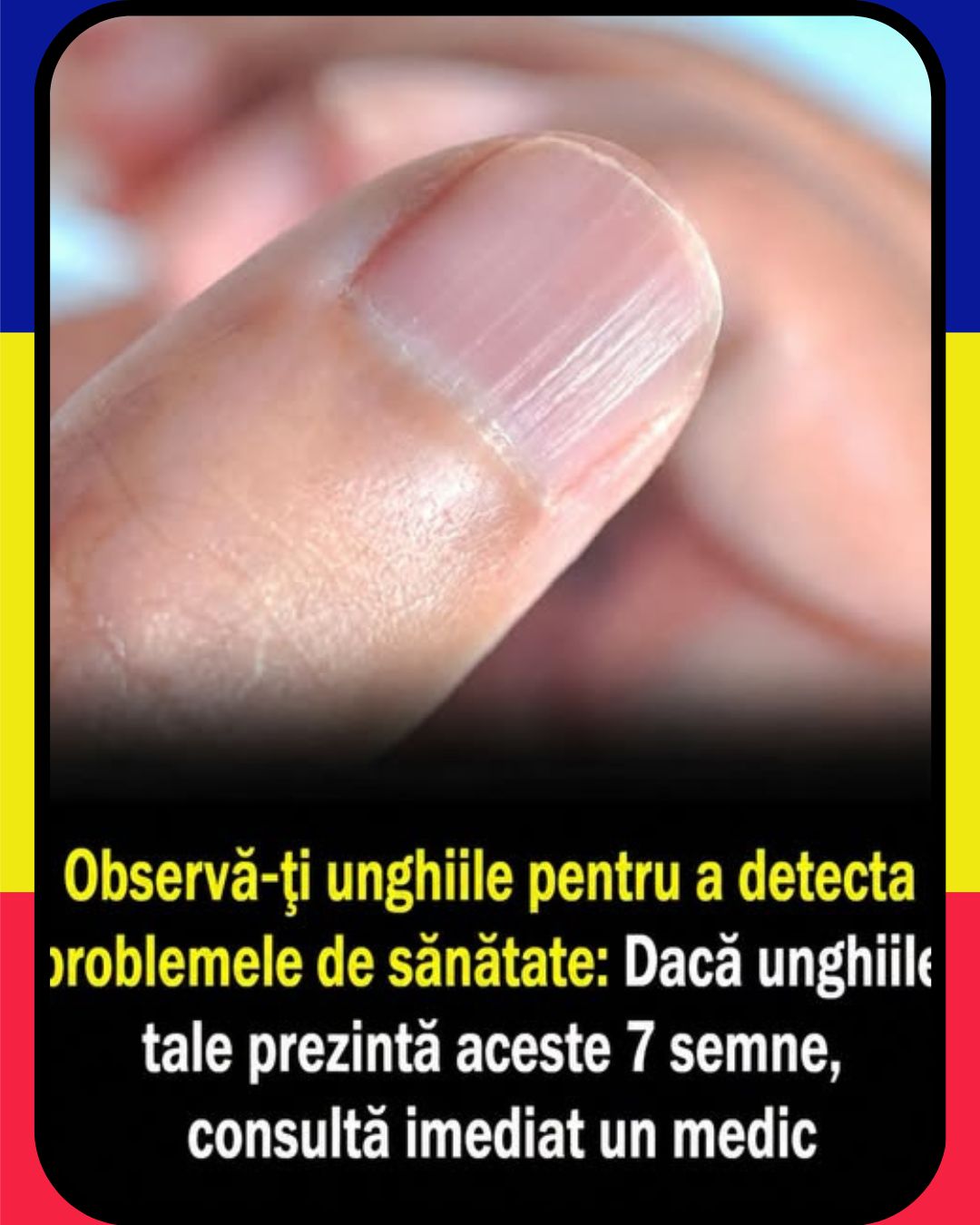 Răsfață-ți unghiile și oferă-le atenția pe care o merită!