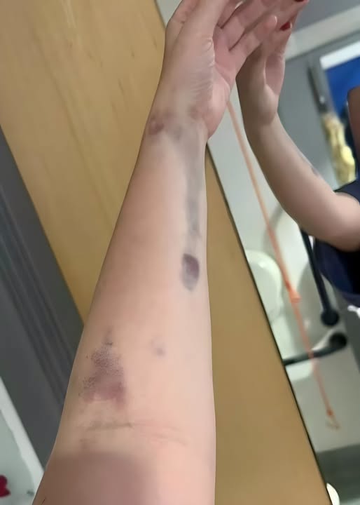 Cazurile au EXPLODAT în România! Primul simptom îți… Vezi mai multe