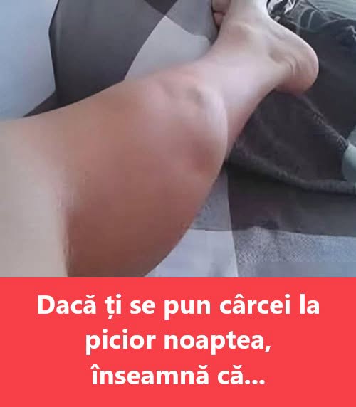 Dacă ți se pun cârcei la picior noaptea, înseamnă că ai… vezi mai mult